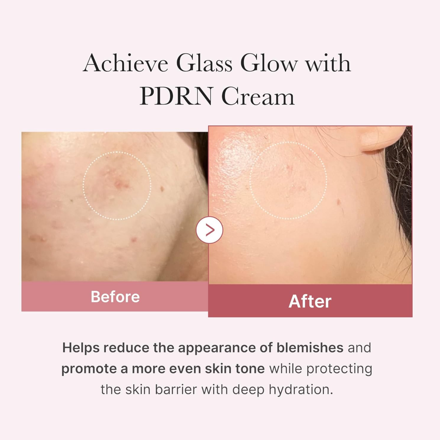 PDRN Pink Hyaluronic Moisturizing - Crema 50 ml