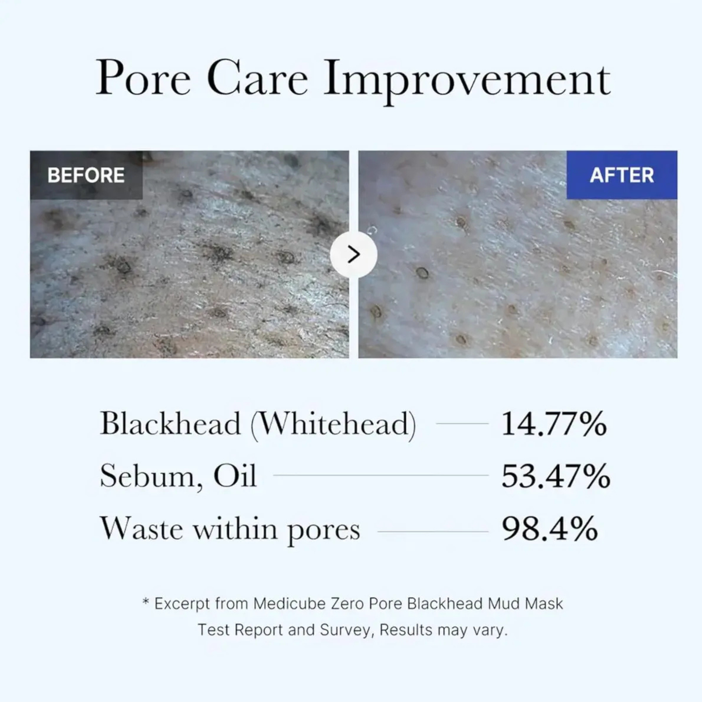 Zero Pore Blackhead Mud Mask – Mascarilla Puntos Negros 100 gr