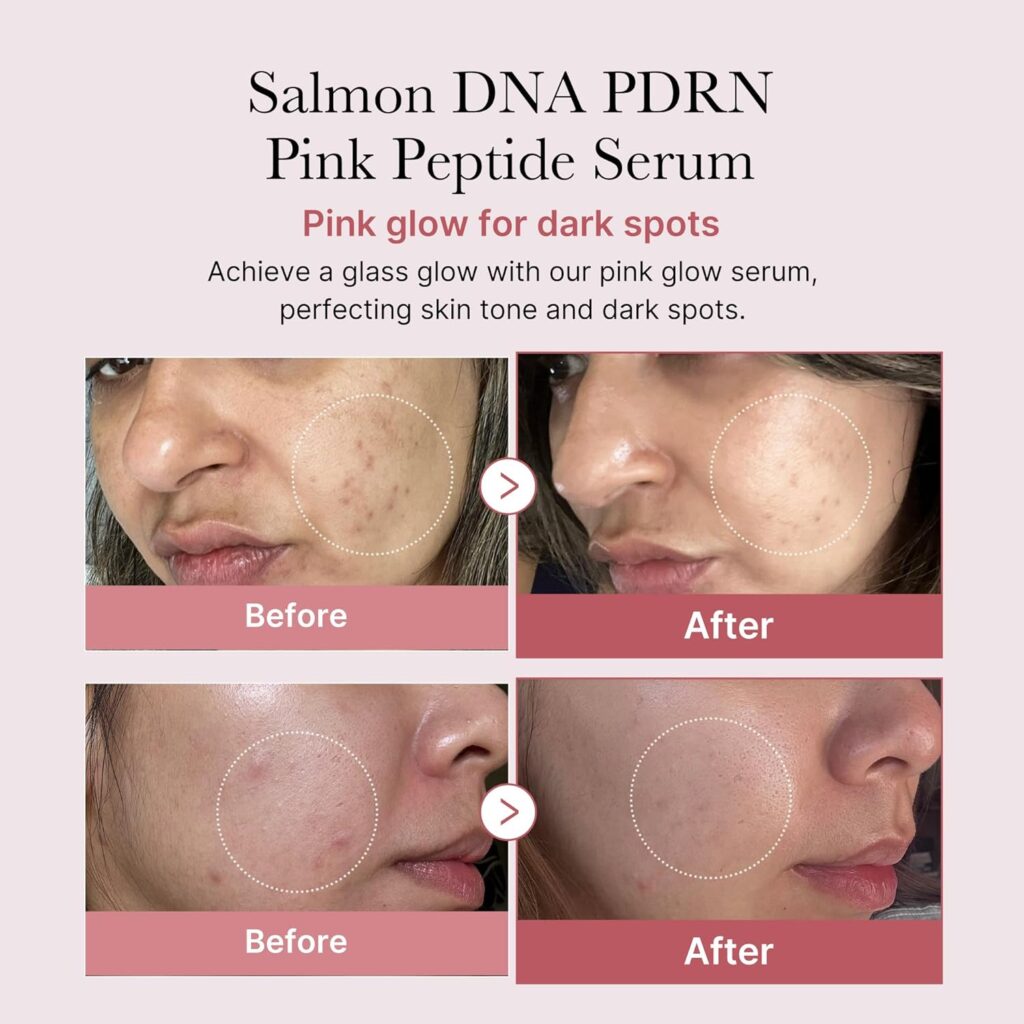 PDRN Pink Peptide Serum – Serum Antiedad 30 ml