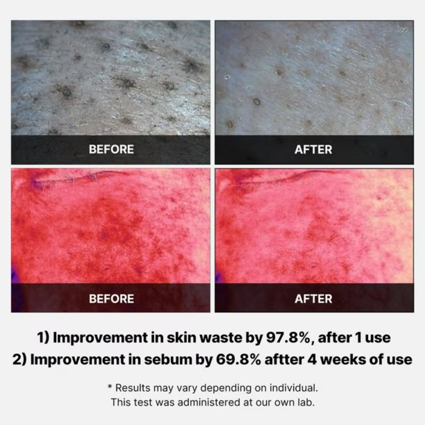 Red Succinic Acid Peeling Pad -Almohadillas Exfoliantes - 70 pzs