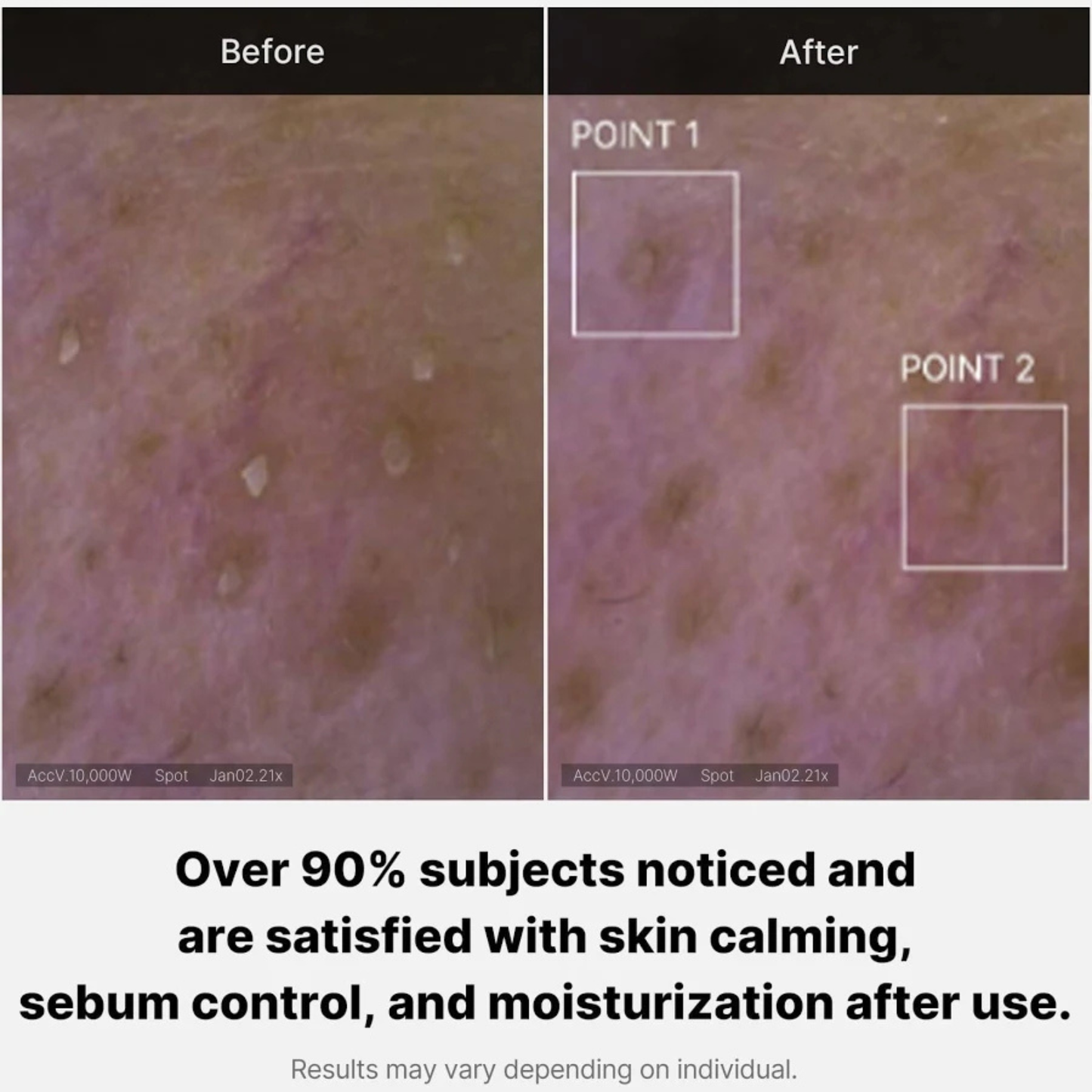 Red Foam Cleanser – Jabón Facial Antirojeces y Acne 120ml