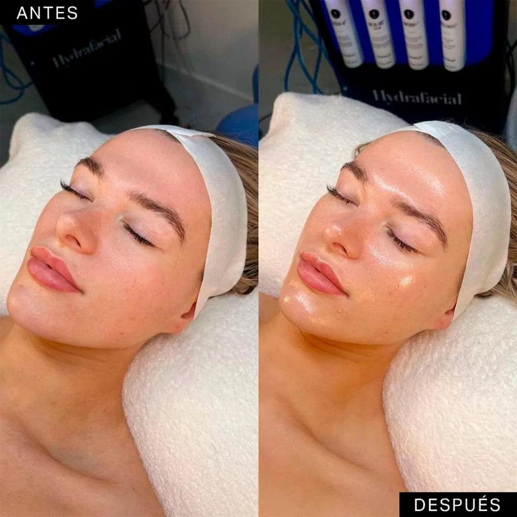 💦 Limpieza Hydra Glow