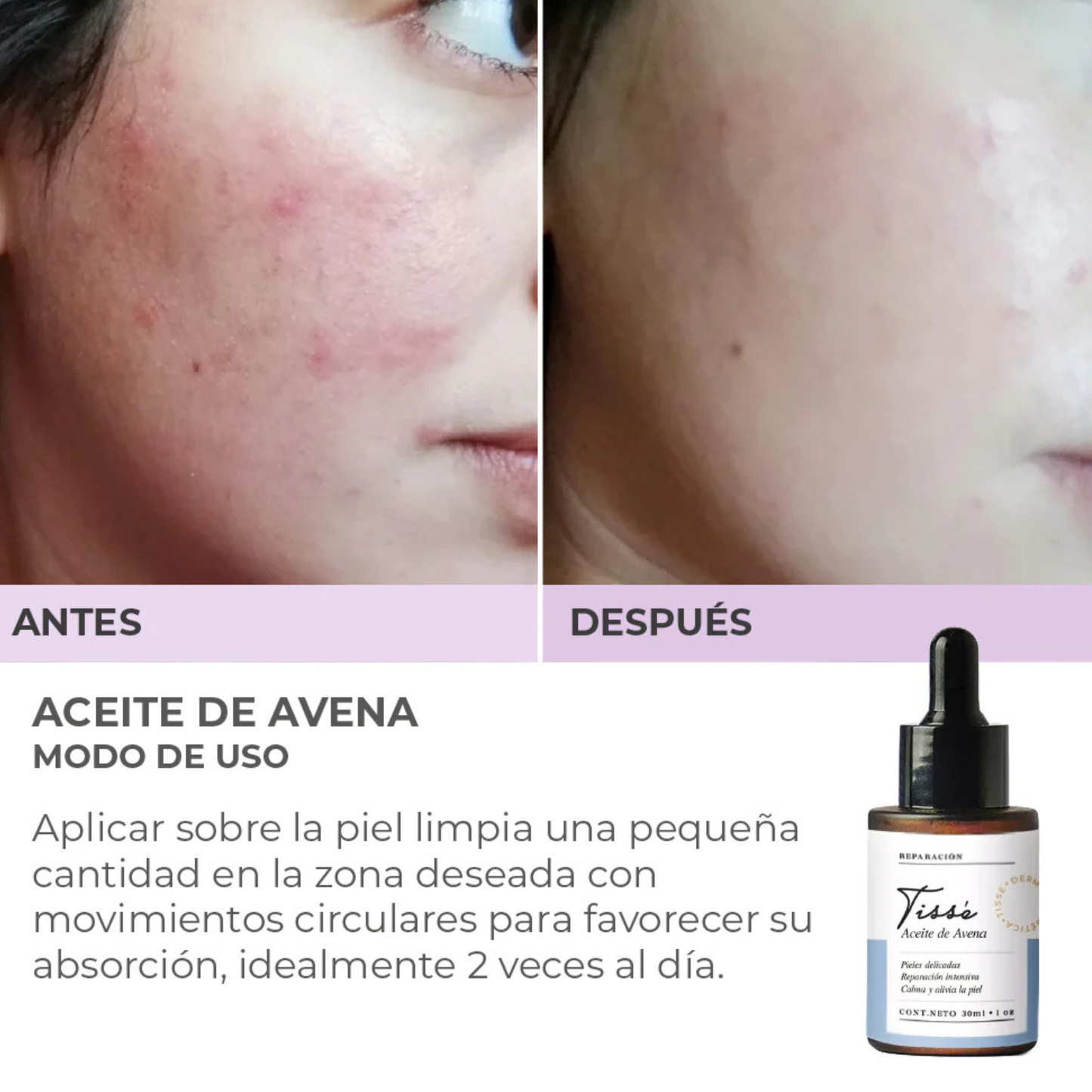 Aceite de Avena 30 ml