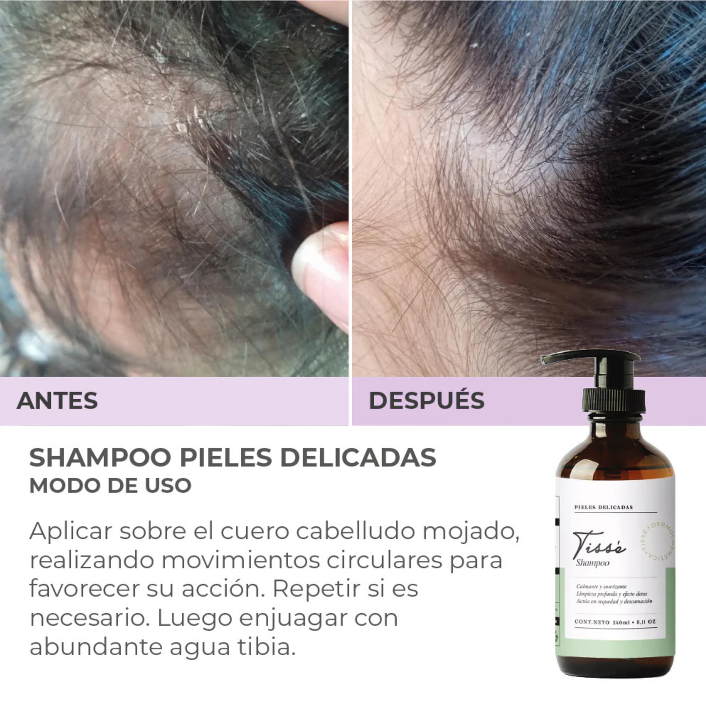 Shampoo Pieles Delicadas 240 ml