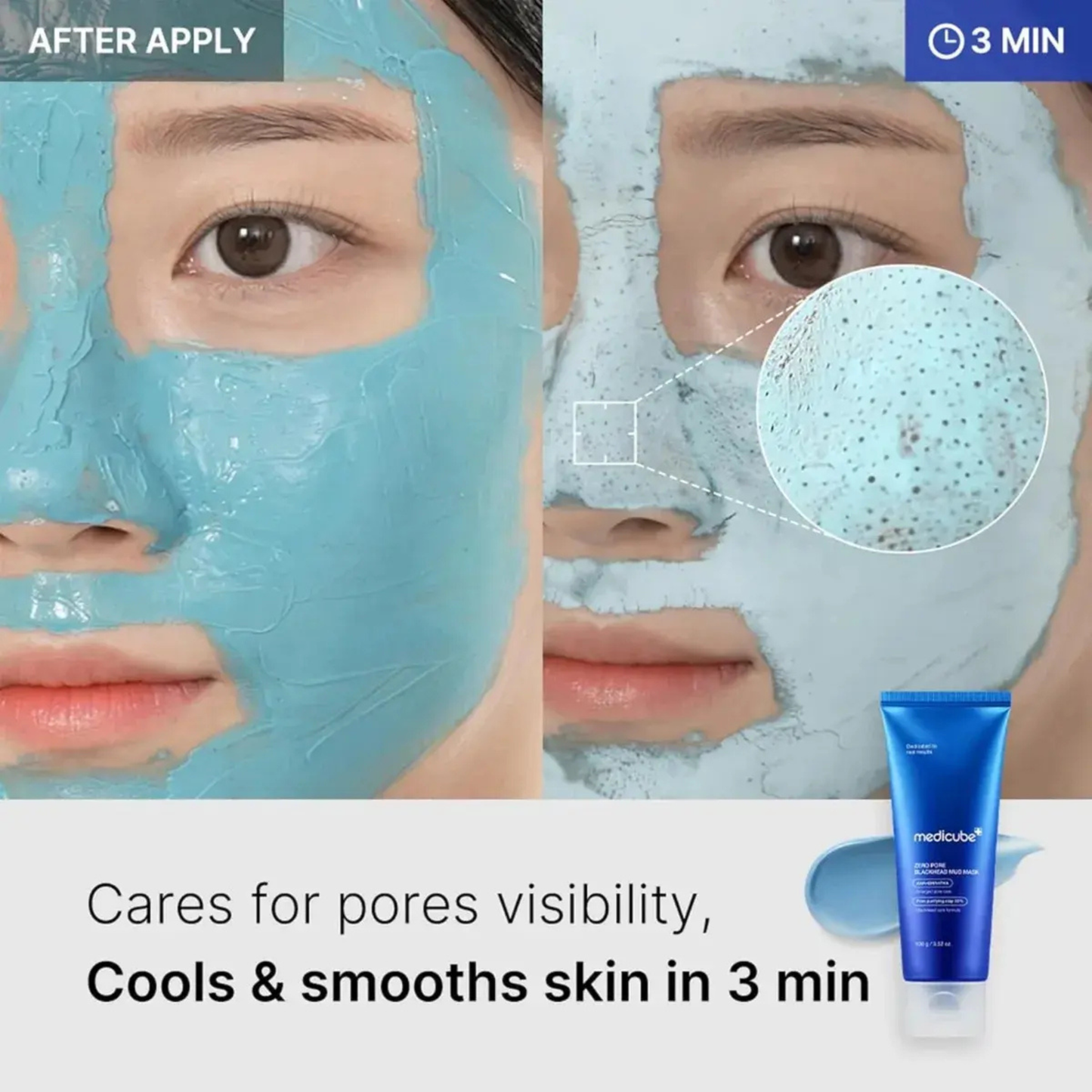Zero Pore Blackhead Mud Mask – Mascarilla Puntos Negros 100 gr