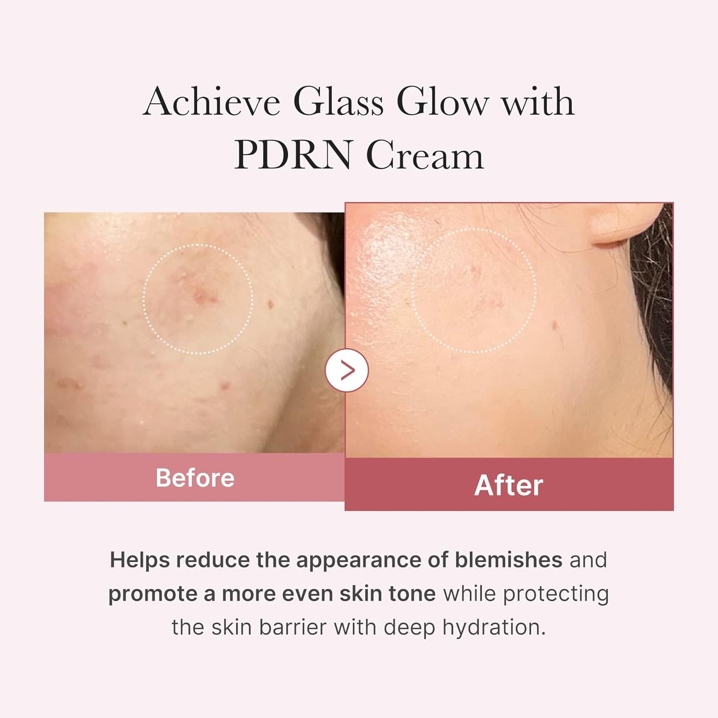 PDRN Pink Hyaluronic Moisturizing - Crema