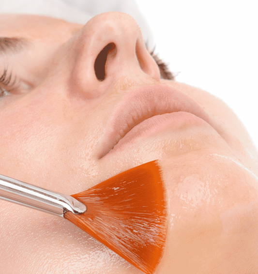 Peeling Mandélico