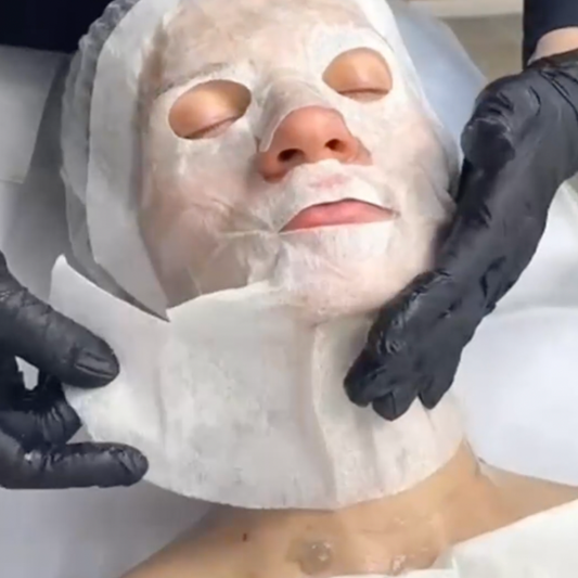 💣 Tratamiento Facial Carboxiterapia CO2