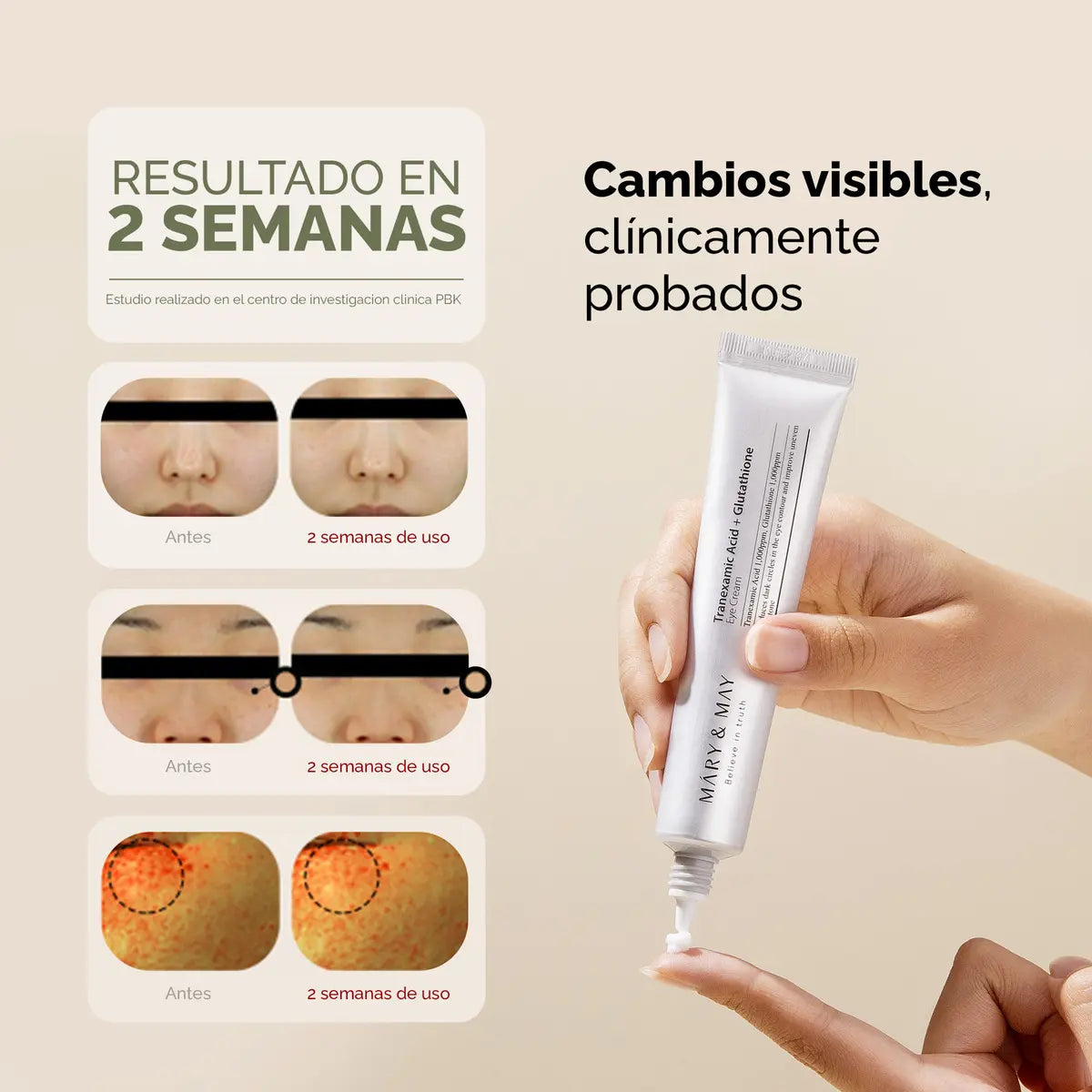 Tranexamic Acid Eye Cream 30 ml Crema Antiojeras