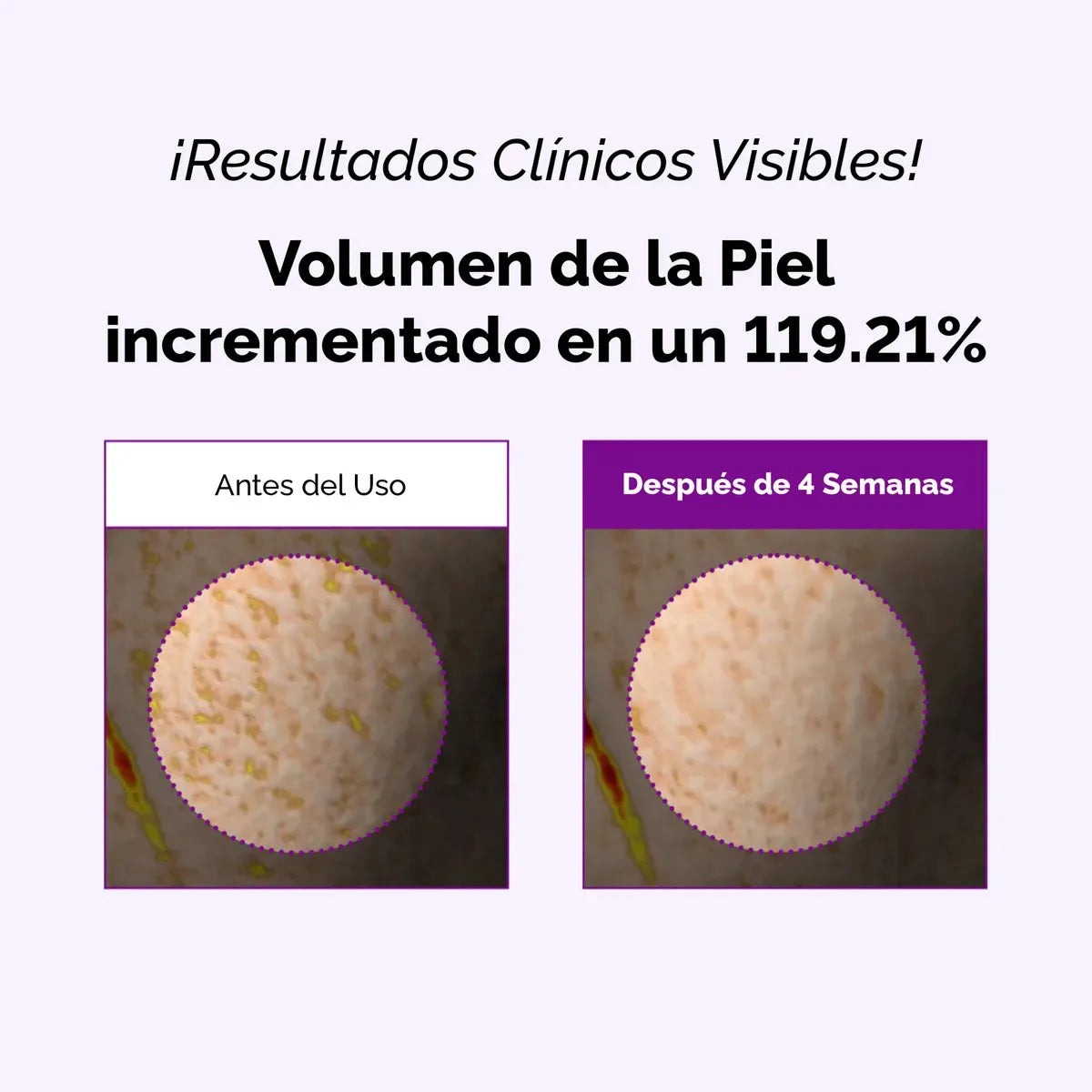 Spicule Collagen PDRN Cream 15G