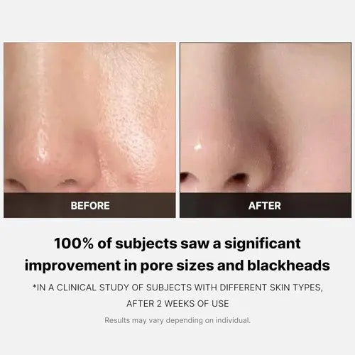 Zero Pore Pad 155 g
