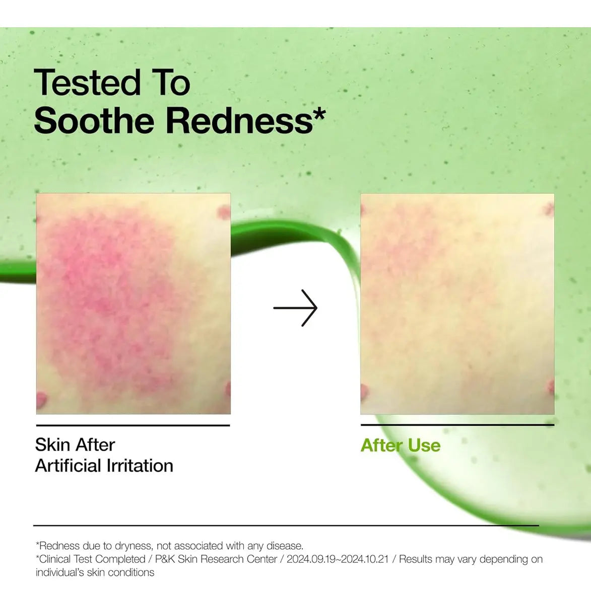 Azelaic Acid 10 Hyaluron Redness Soothing Serum 30 ml